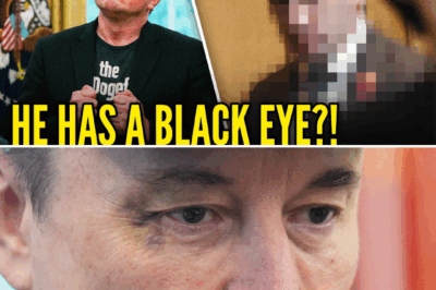 Mystery of Elon Musk’s Black Eye Deepens: Was It Really His Son, or Is a White House Brawl Behind the Billionaire’s Shiner?
