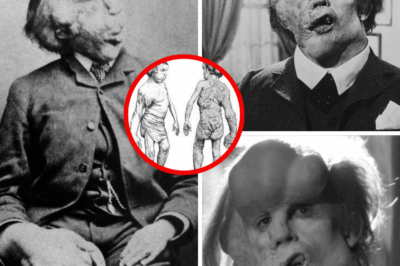 The Heartbreaking Saga of Joseph Merrick: From Freak Show Spectacle to Symbol of Victorian Humanity