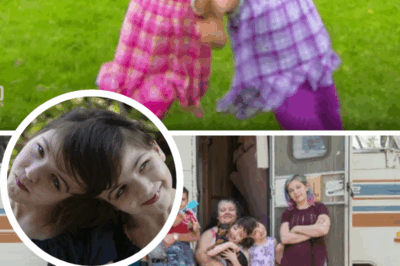 Craniopagus Twins Tatiana and Krista Hogan: A Decade of Defying Odds and Redefining Consciousness at 18