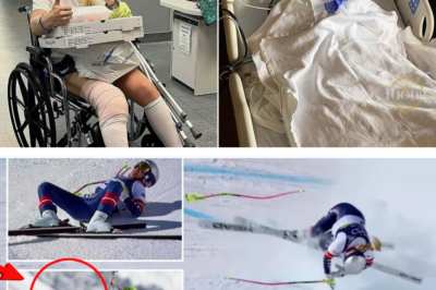 💔⛷️ Broken Leg, Broken Dream? Lindsey Vonn in Stable Condition After Surgery as Fears Grow This Could Be Her Final Ski Run 🕊️