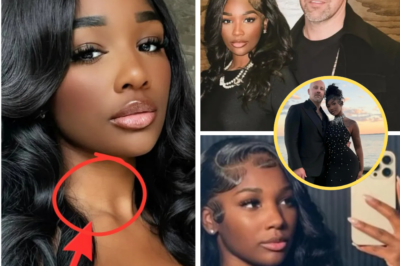 “Those Bruises Tell a Different Story”: Shocking Social Media Photo of Ashly Robinson Fuels Explosive Allegations of Prior Domestic Abuse – Family Questions Whether Her Fairytale Engagement to Joe McCann Was Just a Deadly Illusion as Zanzibar Death Probe Deepens